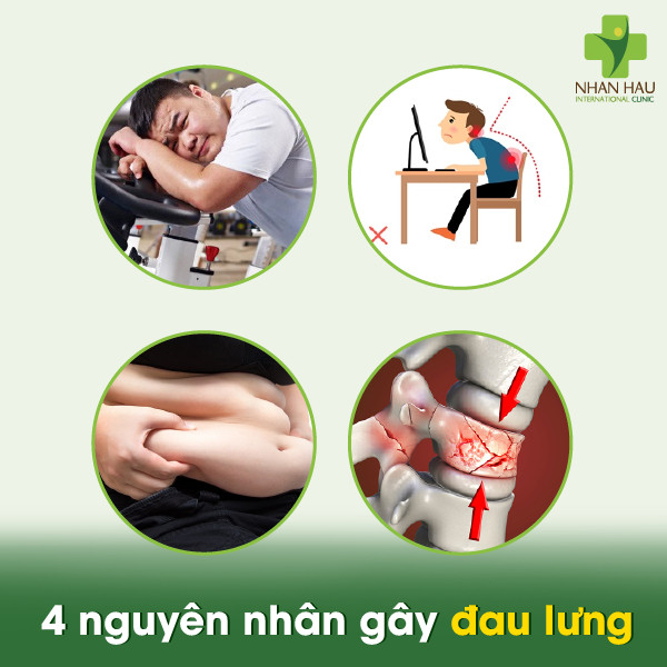 4 nguyên nhân gây đau lưng và cách chữa đơn giản không ngờ 2 4 nguyên nhân gây đau lưng