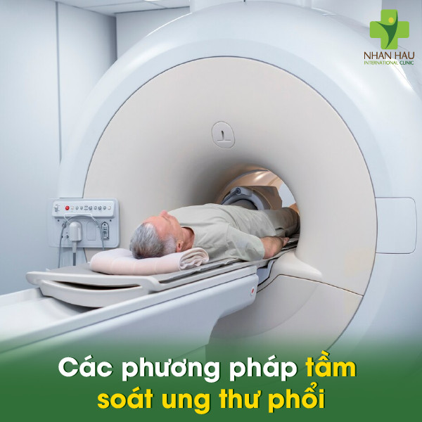 Tầm soát ung thư phổi để phát hiện sớm bệnh ung thư phổi 3 Các phương pháp tầm soát ung thư phổi