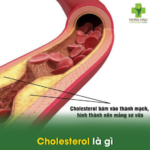 Kiểm Soát Lượng Cholesterol Trong Cơ Thể 1 Cholesterol là gì