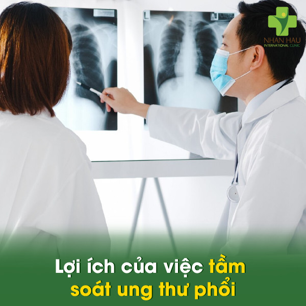 Tầm soát ung thư phổi để phát hiện sớm bệnh ung thư phổi 2 Lợi ích của việc tầm soát ung thư phổi