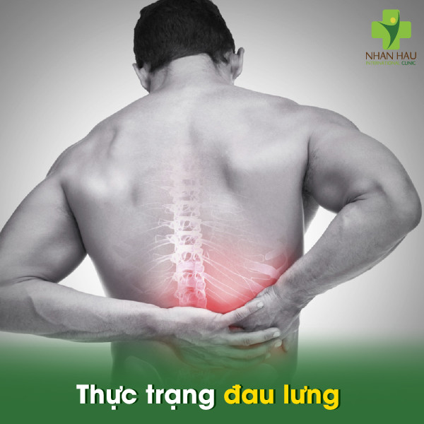 4 nguyên nhân gây đau lưng và cách chữa đơn giản không ngờ 1 Thực trạng đau lưng hiện nay