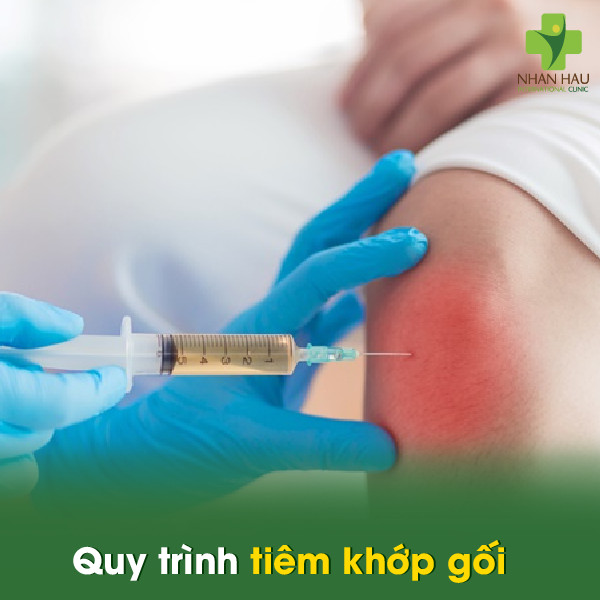 Quy trình tiêm khớp gối