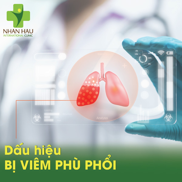 Viêm phù phổi và Các biến chứng đến từ viêm phù phổi 2 Dấu hiệu bị viêm phù phổi