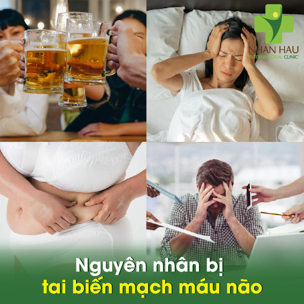 Tai biến mạch máu não nguy hiểm như thế nào 2 Nguyên nhân bị tai biến mạch máu não