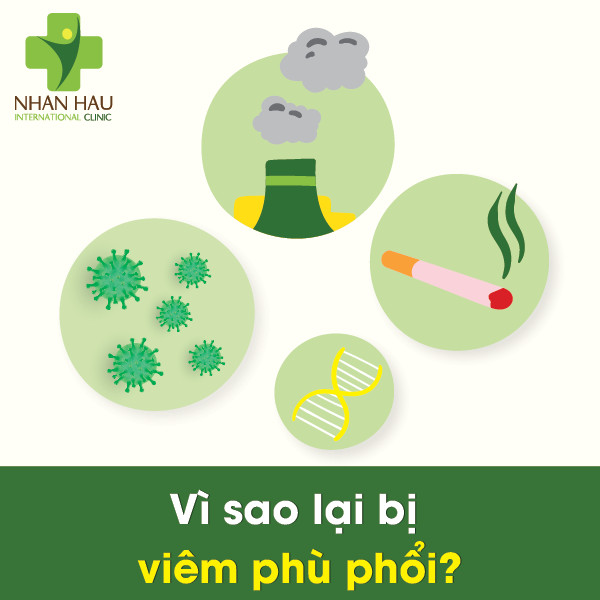 Viêm phù phổi và Các biến chứng đến từ viêm phù phổi 3 Vì sao lại bị viêm phù phổi