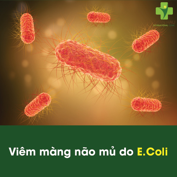 Vacxin viêm màng não mủ và căn bệnh viêm màng não mủ nguy hiểm như thế nào 5 Viêm màng não mủ do E.coli