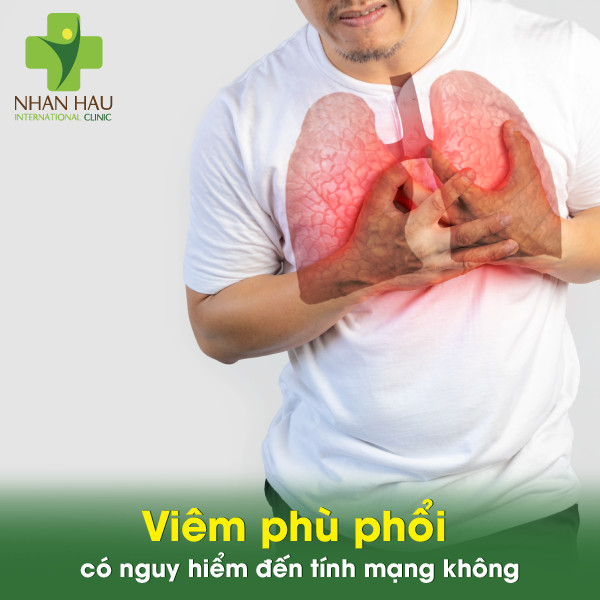 Viêm phù phổi và Các biến chứng đến từ viêm phù phổi 4 Viêm phù phổi có nguy hiểm đến tính mạng không