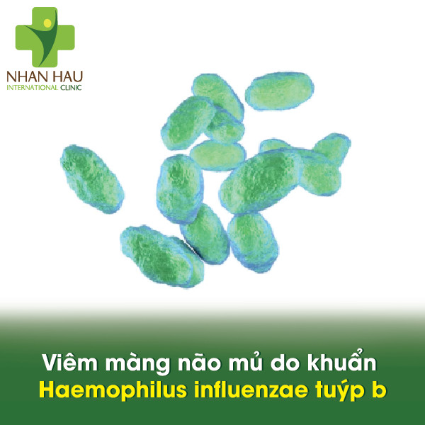 Vacxin viêm màng não mủ và căn bệnh viêm màng não mủ nguy hiểm như thế nào 4 Viêm màng não mủ do khuẩn Haemophilus influenzae tuýp b