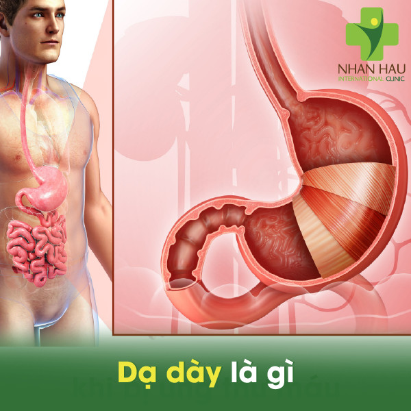 Dạ dày là gì