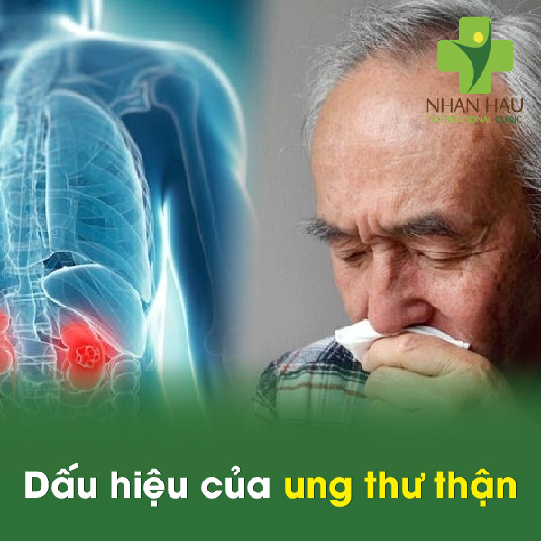 Ung thư thận giai đoạn đầu có chữa được không 2 Dấu hiệu của ung thư thận