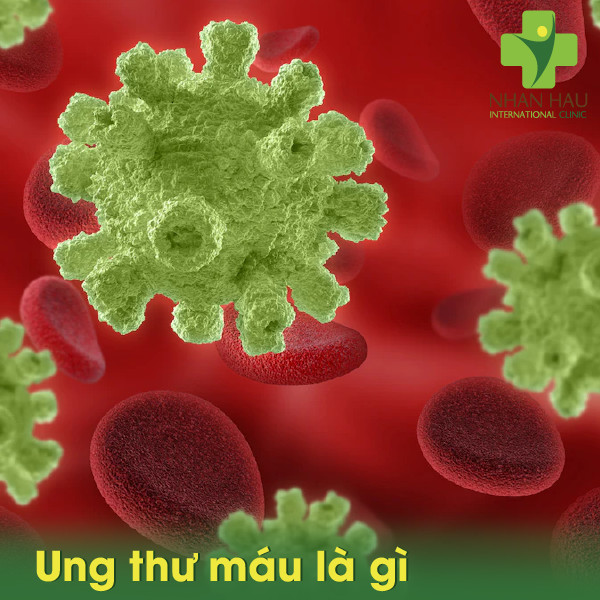 Các triệu chứng ung thư máu và những điều cần lưu ý phòng tránh 2 Ung thư máu là gì