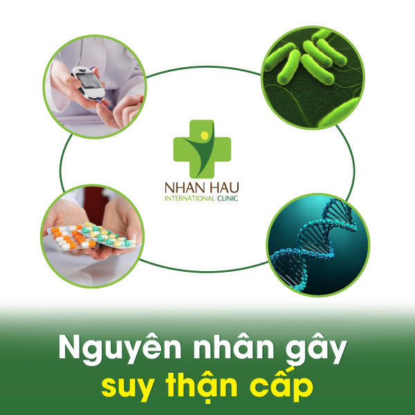 Bệnh suy thận cấp nguy hiểm không 3 Nguyên nhân gây suy thận cấp