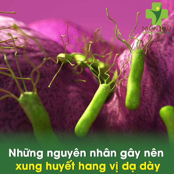 Xung huyết hang vị dạ dày và những nguy cơ gây xung huyết hang vị dạ dày 3 Những nguyên nhân gây nên xung huyết hang vị dạ dày
