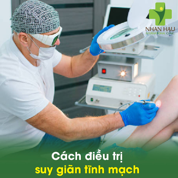 Suy giãn tĩnh mạch và những dấu hiệu lưu ý 5 Cách điều trị suy giãn tĩnh mạch
