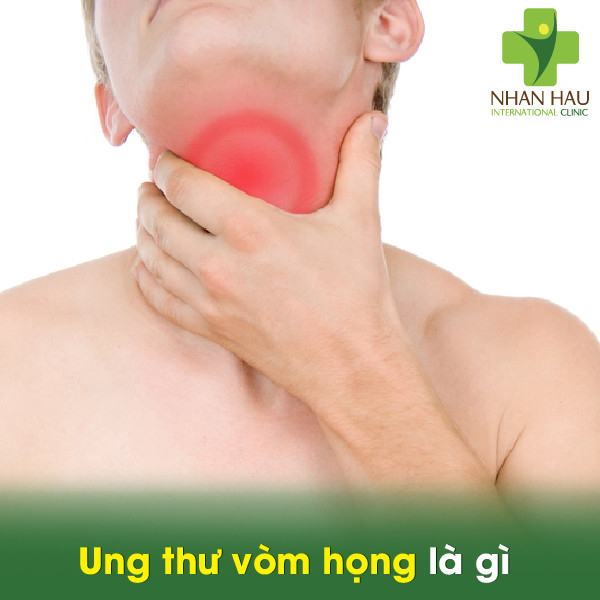Ung thư vòm họng là gì
