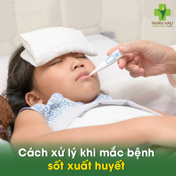 Bệnh sốt xuất huyết: Triệu chứng, nguyên nhân và cách phòng tránh 8 Cách xử lý khi mắc bệnh sốt xuất huyết