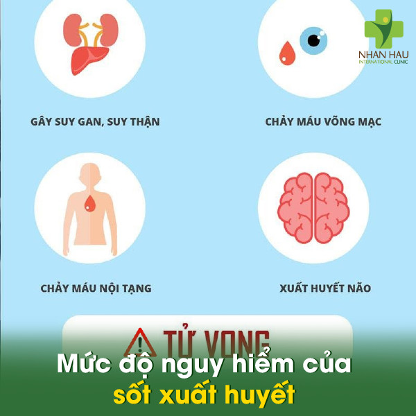 Bệnh sốt xuất huyết: Triệu chứng, nguyên nhân và cách phòng tránh 3 Mức độ nguy hiểm của sốt xuất huyết
