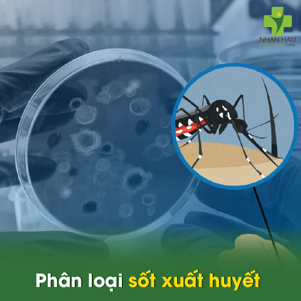 Bệnh sốt xuất huyết: Triệu chứng, nguyên nhân và cách phòng tránh 2 Phân loại sốt xuất huyết