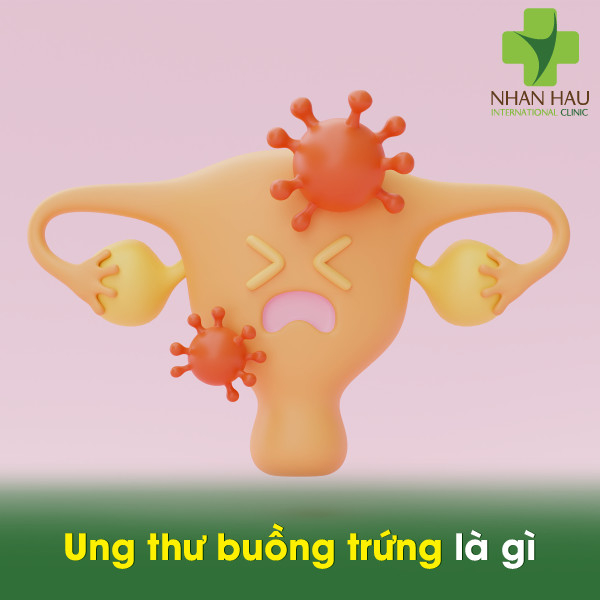 Ung thư buồng trứng và những điều lưu ý cần phòng tránh 2 Ung thư buồng trứng là gì