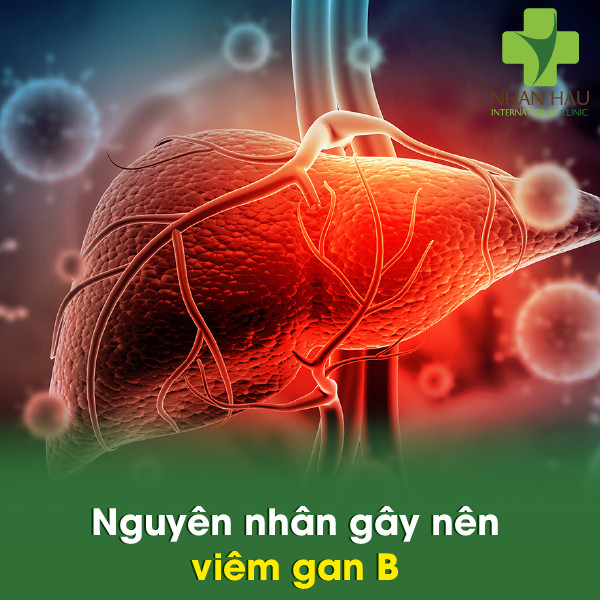 Viêm gan B nếu không chữa trị sẽ gây nên những biến chứng gì 3 Nguyên nhân gây nên viêm gan B