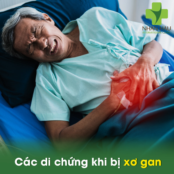 Xơ gan nếu không chữa trị thì sẽ có di chứng gì 6 Các di chứng khi bị xơ gan