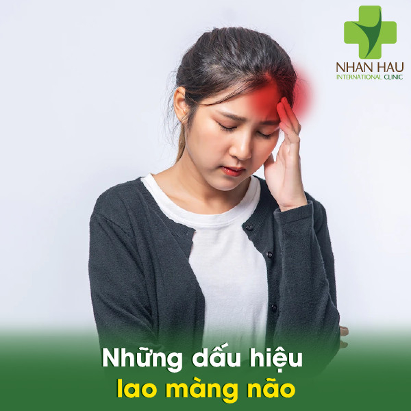 Lao màng não và những dấu hiệu của lao màng não 4 Những dấu hiệu lao màng não