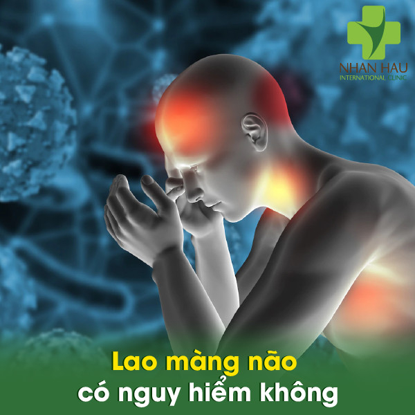 Lao màng não và những dấu hiệu của lao màng não 5 Lao màng não có nguy hiểm không