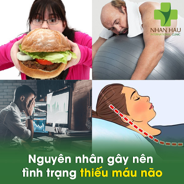 Những nguyên nhân gây thiếu máu não mà bạn nên lưu ý 3 Nguyên nhân gây nên tình trạng thiếu máu não