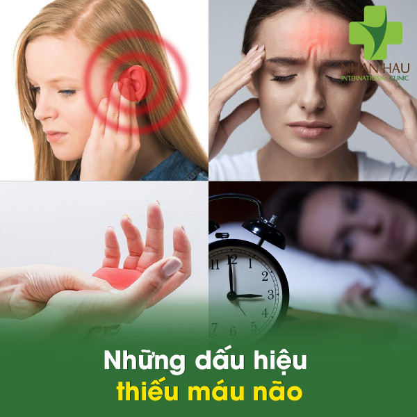 Những nguyên nhân gây thiếu máu não mà bạn nên lưu ý 4 Những dấu hiệu thiếu máu não