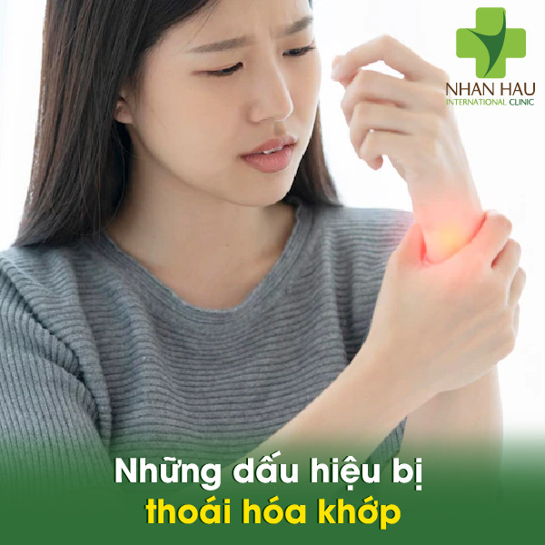 Thoái hóa khớp và những biến chứng gây thoái hóa khớp 4 Những dấu hiệu bị thoái hóa khớp