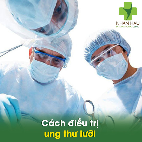 Ung thư lưỡi và những nguyên nhân nên lưu ý 7 Cách điều trị ung thư lưỡi
