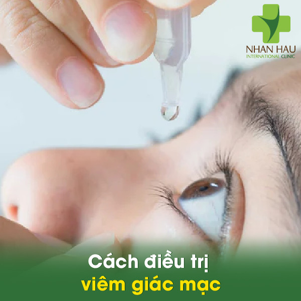 Viêm giác mạc và cách khắc phục 6 Cách điều trị viêm giác mạc