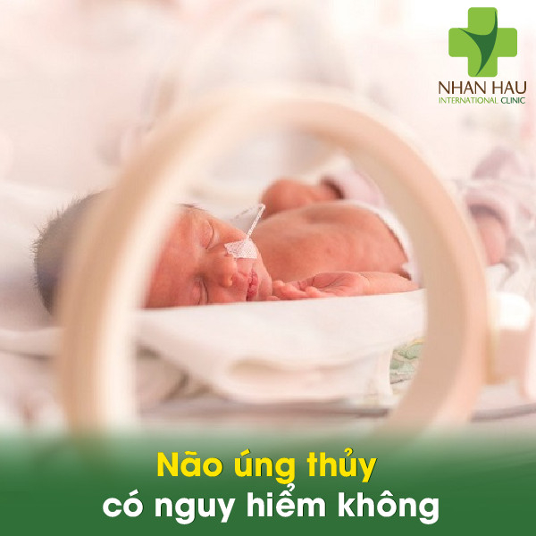 Não úng thủy và những điều lưu ý ở bệnh não úng thủy 5 Não úng thủy có nguy hiểm không
