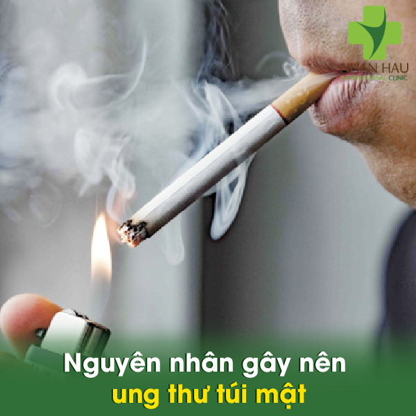 Các vấn đề cần nên lưu ý để phòng tránh ung thư túi mật 3 Nguyên nhân gây nên ung thư túi mật