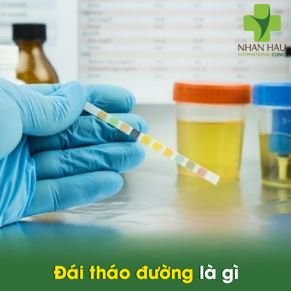 Những yếu tố gây nên bệnh đái tháo đường 1 Đái tháo đường là gì