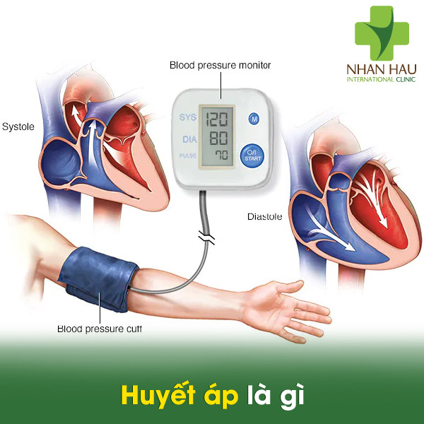 Tăng huyết áp: Triệu chứng và cách kiểm soát tăng huyết áp 1 Huyết áp là gì