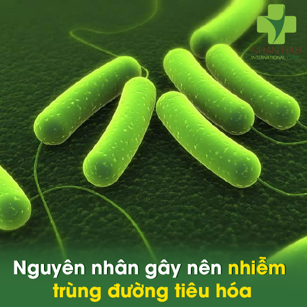Nhiễm trùng đường tiêu hóa và biến chứng nên lưu ý 3 Nguyên nhân gây nên nhiễm trùng đường tiêu hóa