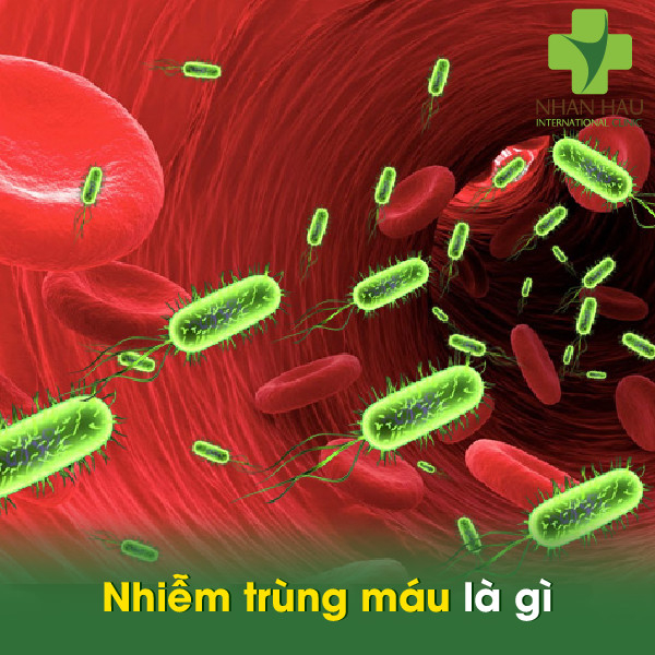 Nhiễm trùng máu nếu không điều trị sẽ gây ra vấn đề gì? 2 Nhiễm trùng máu là gì