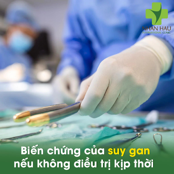 Suy gan và những dấu hiệu của suy gan 5 Biến chứng của suy gan nếu không điều trị kịp thời