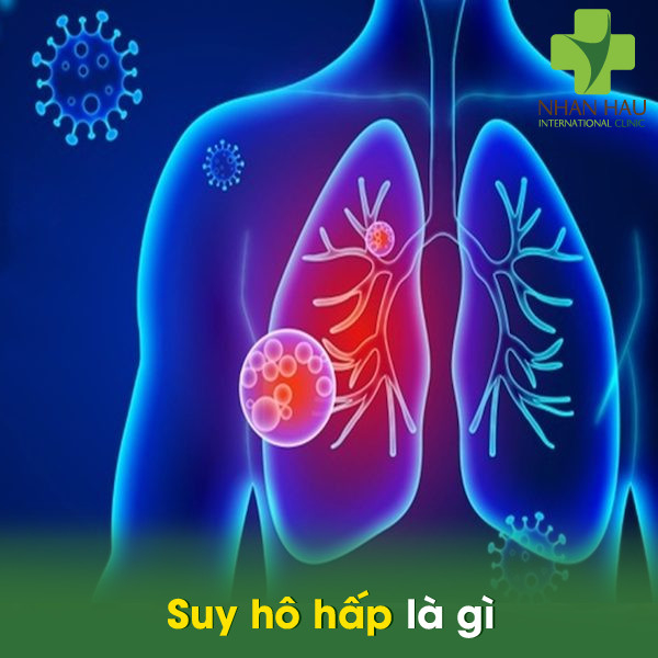 Suy hô hấp và những nguyên nhân cần lưu ý 1 Suy hô hấp là gì