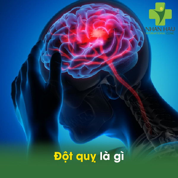 Đột quỵ sẽ có những nguy hiểm gì 1 Đột quỵ là gì