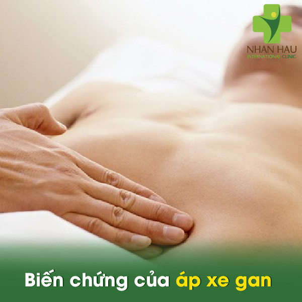 Bệnh áp xe gan sẽ gây nên những nguy hiểm gì cho cơ thể 5 Biến chứng của áp xe gan