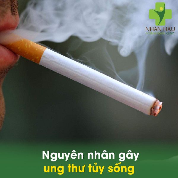 Ung thư tủy sống gây nên những biến chứng gì 3 Nguyên nhân gây ung thư tủy sống