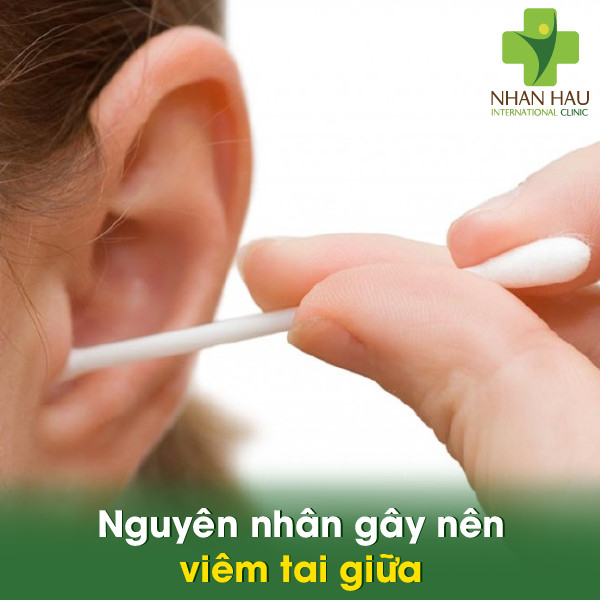 Viêm tai giữa và những nguyên nhân gây nên viêm tai giữa 3 Nguyên nhân gây nên viêm tai giữa