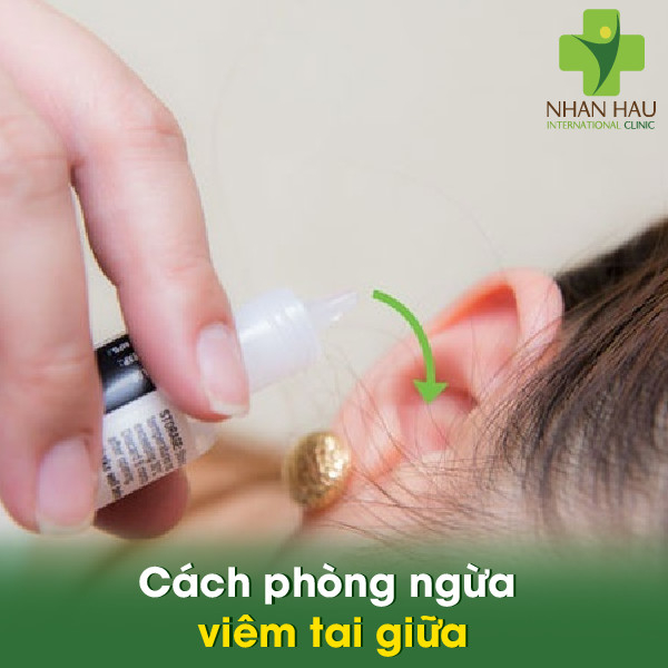 Viêm tai giữa và những nguyên nhân gây nên viêm tai giữa 7 Cách phòng ngừa viêm tai giữa