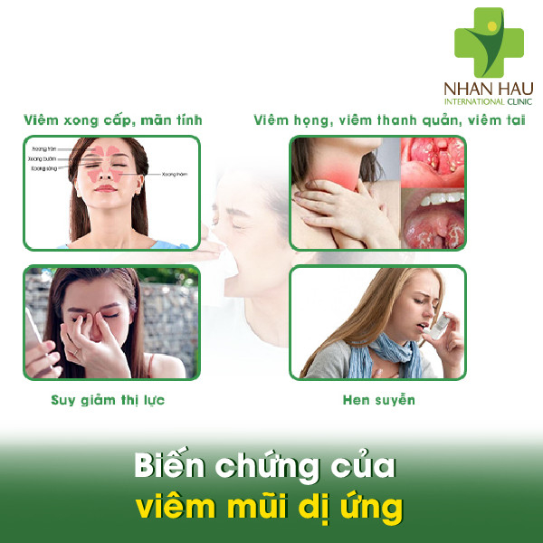 Viêm mũi dị ứng là gì và cách điều trị ra sao? 5 Biến chứng của viêm mũi dị ứng