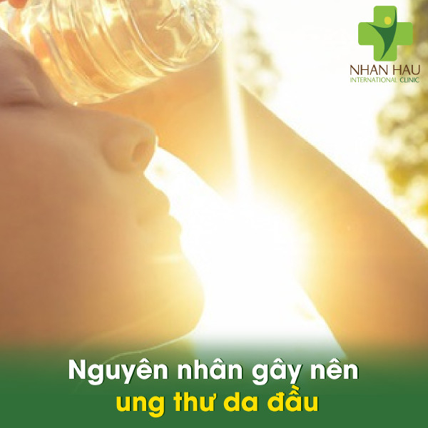 Ung thư da đầu và những triệu chứng 3 Nguyên nhân gây nên ung thư da đầu