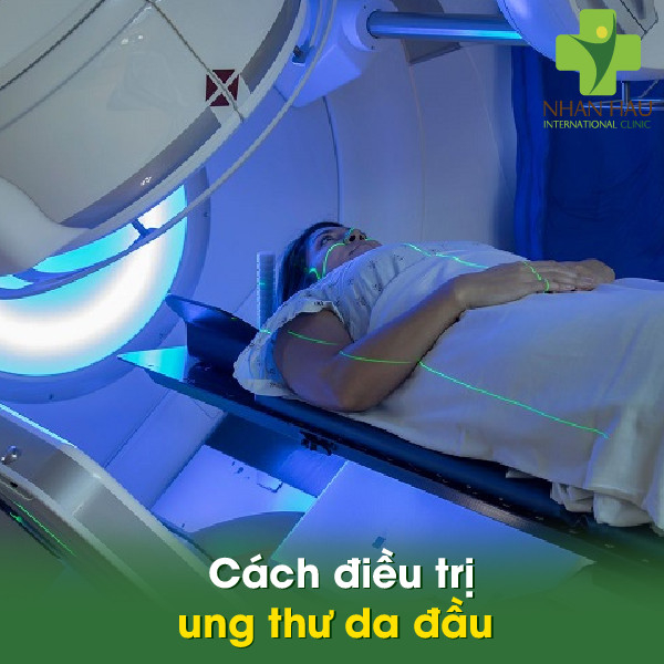 Ung thư da đầu và những triệu chứng 5 Cách điều trị ung thư da đầu