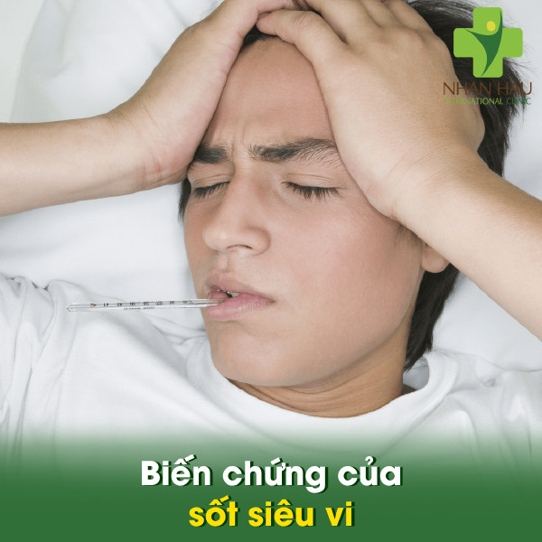 Sốt siêu vi và những dấu hiệu của sốt siêu vi 4 Những cách điều trị sốt siêu vi
