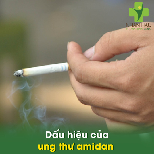 Ung thư Amidan có nguy hiểm không 4 Dấu hiệu của ung thư amidan